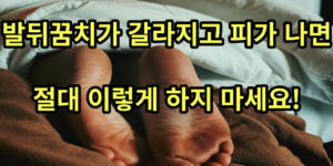 발뒤꿈치 썸네일