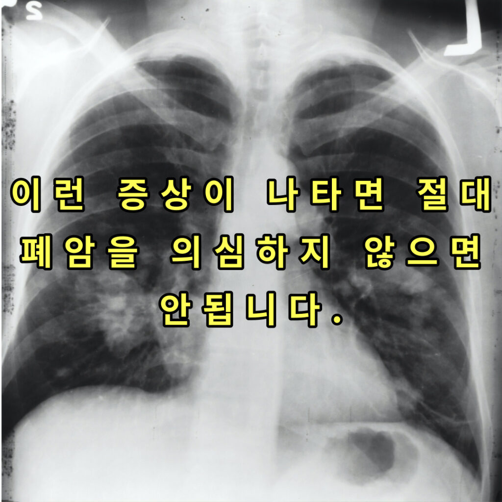 폐암 썸네일