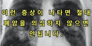 폐암 썸네일